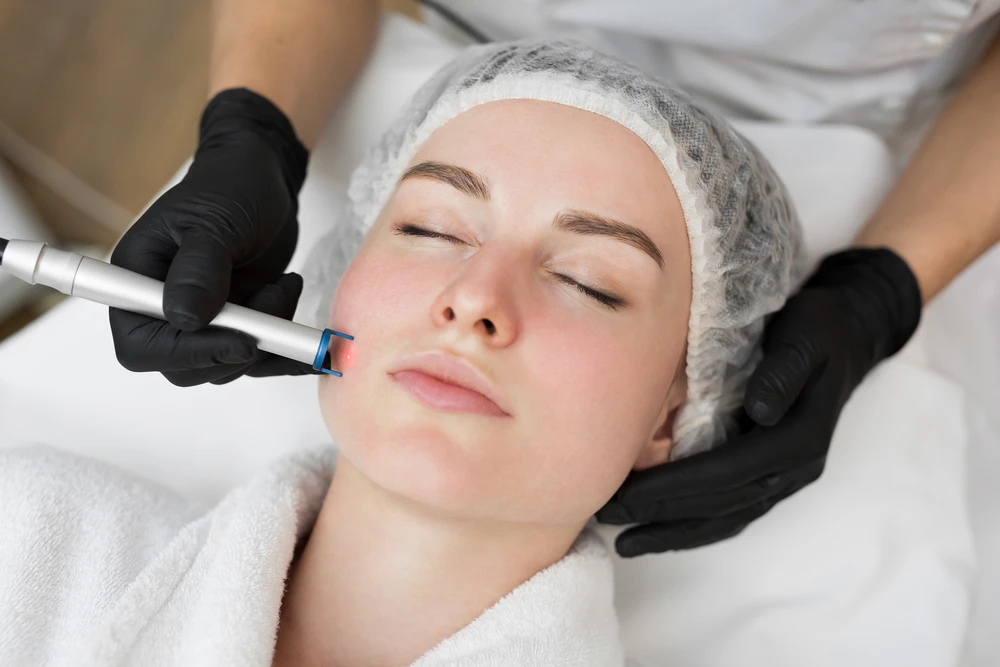 Microneedling service being performed on a woman's face